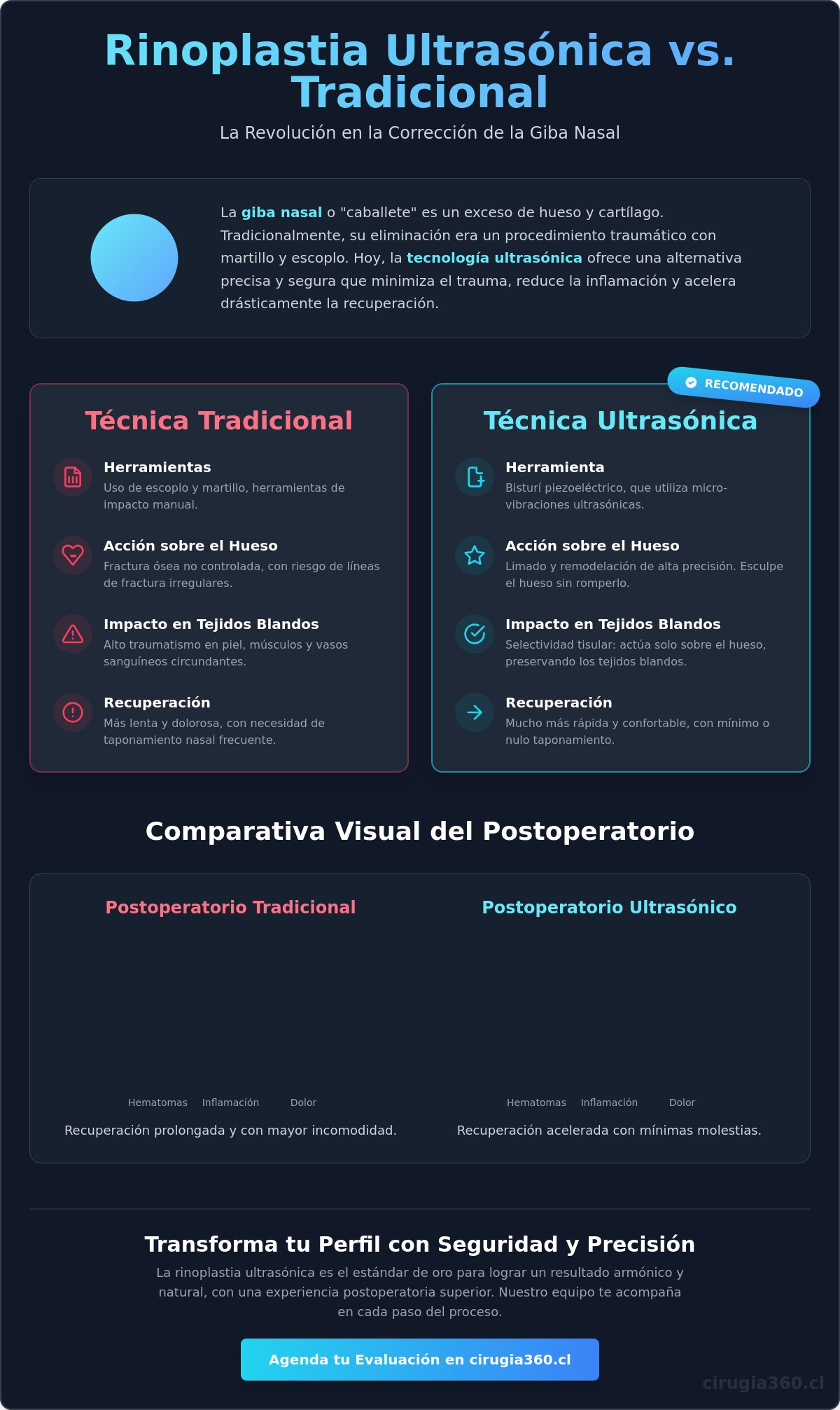 Infografia de Rinoplastia Ultrasónica para Giba Nasal en Chile: Precisión y Resultados Naturales