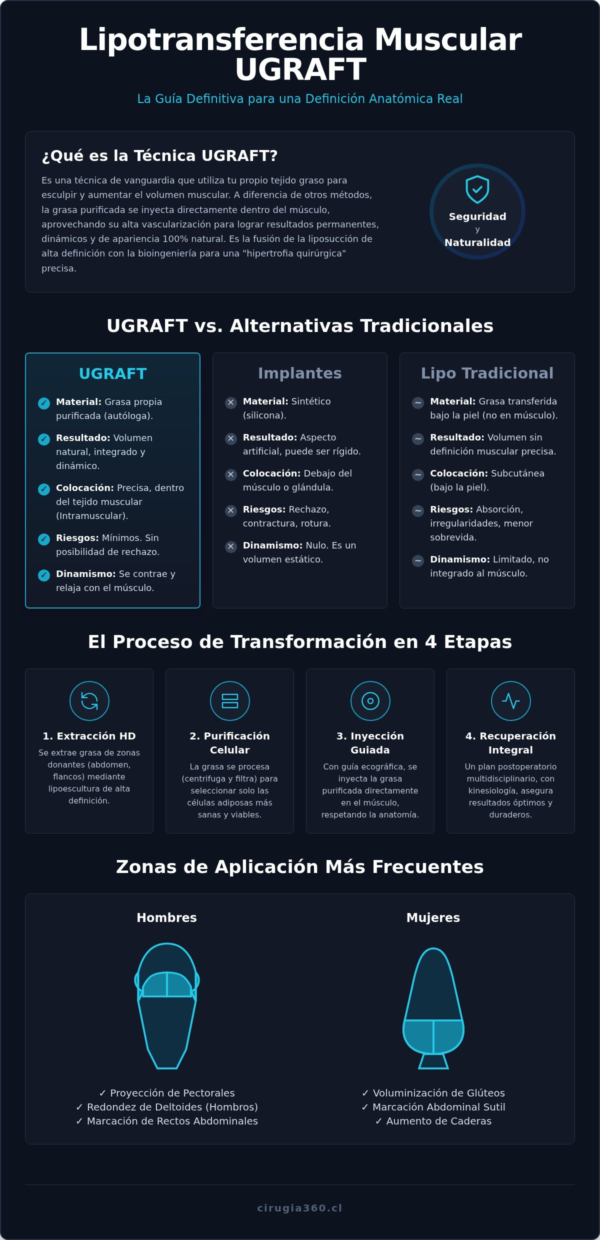 Infografia de Lipotransferencia Muscular UGRAFT en Chile: La Guía Definitiva de Alta Definición 2026